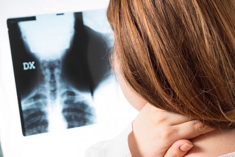 X -Ray της περιοχής του τραχήλου